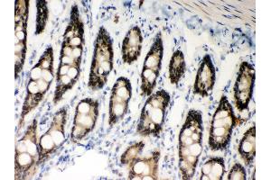 Immunohistochemistry (IHC) image for anti-Mismatch Repair Protein 2 (MSH2) (AA 337-583) antibody (ABIN3043885)