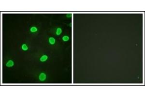 Immunofluorescence analysis of HeLa cells, using Histone H4 (Acetyl-Lys5) Antibody.