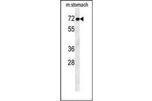Western Blotting (WB) image for anti-Activating Transcription Factor 7 Interacting Protein 2 (ATF7IP2) (AA 325-355), (Middle Region) antibody (ABIN953344)