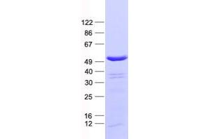 PABPC5 Protein (His tag)