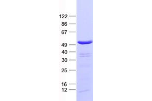 PABPC5 Protein (His tag)