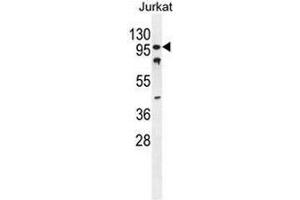 CWC22 Antibody (N-term) western blot analysis in Jurkat cell line lysates (35µg/lane). (CWC22 抗体  (N-Term))
