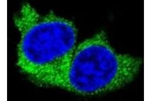 Confocal immunofluorescent analysis of MMP1 antibody with MDA-MB231 cells followed by Alexa Fluor 488-conjugated goat anti-rabbit lgG (green). (MMP1 抗体  (AA 317-347))