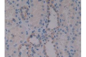 DAB staining on IHC-P; Samples: Human Kidney Tissue (Insulin Like Protein 3 (AA 2-129) 抗体)
