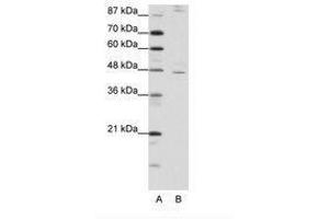 Image no. 1 for anti-Nuclear Receptor Subfamily 2, Group F, Member 2 (NR2F2) (AA 311-360) antibody (ABIN202470) (NR2F2 抗体  (AA 311-360))