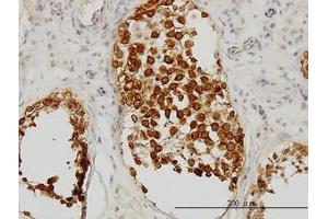 Image no. 1 for anti-Deleted in Azoospermia 1 (DAZ1) (AA 21-121) antibody (ABIN598640) (DAZ1 抗体  (AA 21-121))