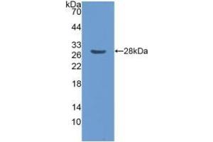 Detection of Recombinant CENPF, Human using Polyclonal Antibody to Centromere Protein F (CENPF) (CENPF 抗体  (AA 436-637))