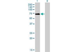 Western Blot analysis of F2 expression in transfected 293T cell line by F2 monoclonal antibody (M01), clone 1B7. (Prothrombin 抗体  (AA 263-362))