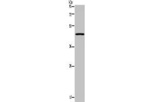 Gel: 8 % SDS-PAGE, Lysate: 40 μg, Lane: Mouse lung tissue, Primary antibody: ABIN7130211(MECP2 Antibody) at dilution 1/300, Secondary antibody: Goat anti rabbit IgG at 1/8000 dilution, Exposure time: 3 minutes (MECP2 抗体)