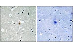 Immunohistochemistry analysis of paraffin-embedded human brain tissue, using E2A (Ab-355) Antibody. (TCF3 抗体  (AA 321-370))