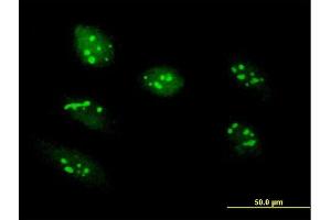 Immunofluorescence of purified MaxPab antibody to RRS1 on HeLa cell. (RRS1 抗体  (AA 1-365))