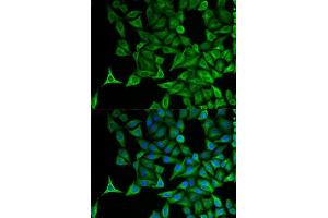 Immunofluorescence analysis of HeLa cells using KRT20 antibody.