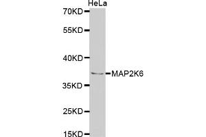 Western blot analysis of extracts of HeLa cells, using MAP2K6 antibody. (MAP2K6 抗体)