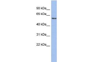 Western Blotting (WB) image for anti-General Transcription Factor IIH, Polypeptide 1, 62kDa (GTF2H1) (Middle Region) antibody (ABIN2792659)