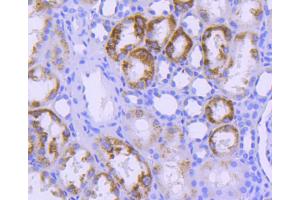 Immunohistochemistry (Paraffin-embedded Sections) (IHC (p)) image for anti-Signal Transducer and Activator of Transcription 6, Interleukin-4 Induced (STAT6) antibody (ABIN5557533)
