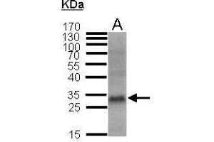 Western Blotting (WB) image for anti-Cyclin-Dependent Kinase Inhibitor 1B (p27, Kip1) (CDKN1B) antibody (ABIN2854753)