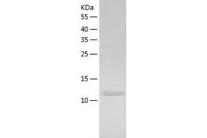 Western Blotting (WB) image for GLI Pathogenesis-Related 2 (GLIPR2) (AA 1-154) protein (His tag) (ABIN7288811) (GLIPR2 Protein (AA 1-154) (His tag))