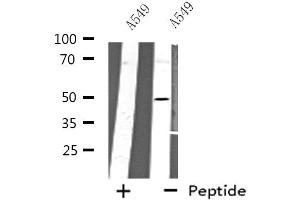 Western blot analysis of extracts from A549 cells using CHRNA10 antibody. (CHRNA10 抗体  (C-Term))