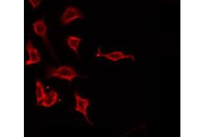 ABIN6266613 staining A549 by IF/ICC. (PTH 抗体  (Internal Region))