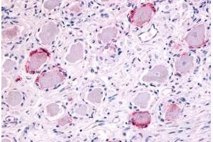 Anti-TRPA1 antibody  ABIN1049431 IHC staining of human ganglion cells. (TRPA1 抗体  (Internal Region))
