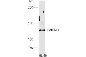 HL-60 lysate probed with Rabbit Anti-FAM83H Polyclonal Antibody, Unconjugated  at 1:5000 for 90min at 37˚C. (FAM83H 抗体  (AA 1001-1179))