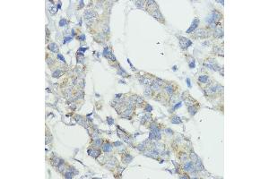 Immunohistochemistry (IHC) image for anti-Nucleotide-Binding Oligomerization Domain Containing 1 (NOD1) (AA 1-270) antibody (ABIN3021838)