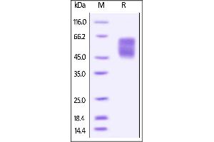 SDS-PAGE (SDS) image for V-Set Domain Containing T Cell Activation Inhibitor 1 (VTCN1) (AA 29-258) (Active) protein (His tag,AVI tag,Biotin) (ABIN4949004)