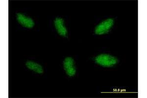 Immunofluorescence of purified MaxPab antibody to NHEJ1 on HepG2 cell. (NHEJ1 抗体  (AA 1-299))