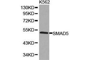 Western Blotting (WB) image for anti-SMAD, Mothers Against DPP Homolog 5 (SMAD5) antibody (ABIN1874857) (SMAD5 抗体)