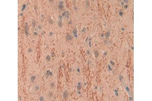 Used in DAB staining on fromalin fixed paraffin- embedded Kidney tissue (BCR 抗体  (AA 1042-1243))