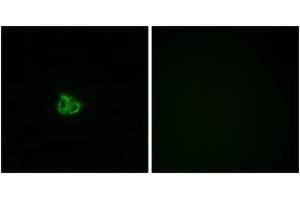 Immunofluorescence analysis of COS7 cells, using Stathmin 1 (Phospho-Ser15) Antibody. (Stathmin 1 抗体  (pSer16))