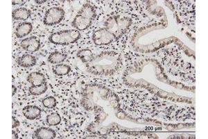 Image no. 1 for anti-TATA Box Binding Protein Associated Factor 11 (TAF11) (AA 158-211) antibody (ABIN598958) (TAF11 抗体  (AA 158-211))