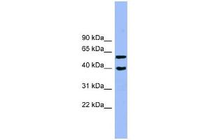 ALLC antibody used at 1 ug/ml to detect target protein. (Allantoicase 抗体  (N-Term))