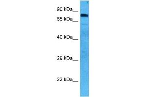 Western Blotting (WB) image for anti-Heat Shock Protein 90kDa alpha (Cytosolic), Class B Member 1 (HSP90AB1) (N-Term) antibody (ABIN2792217)