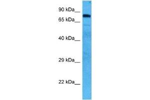 Host:  Mouse  Target Name:  HSP90AB1  Sample Tissue:  Mouse Skeletal Muscle  Antibody Dilution:  1ug/ml (HSP90AB1 抗体  (N-Term))