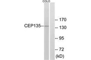 Western blot analysis of extracts from COLO cells, using CEP135 Antibody. (CEP135 抗体  (AA 1081-1130))