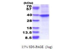 SDS-PAGE (SDS) image for Homeobox A9 (HOXA9) (AA 1-272) protein (His tag) (ABIN5853687) (HOXA9 Protein (AA 1-272) (His tag))