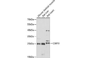 Western blot analysis of extracts of various cell lines, using CSRP3 antibody (ABIN6129258, ABIN6139141, ABIN6139143 and ABIN6222244) at 1:1000 dilution. (CSRP3 抗体  (AA 1-194))