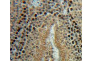 Used in DAB staining on fromalin fixed paraffin-embedded testis tissue (HSPH1 抗体  (AA 595-733))