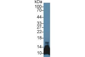 Detection of CCL6 in Mouse Pancreas lysate using Polyclonal Antibody to Chemokine (C-C motif) ligand 6 (CCL6) (CCL6 抗体  (AA 22-116))