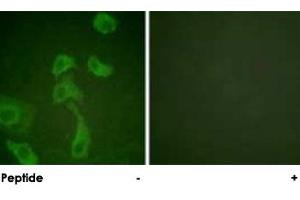 Immunofluorescence analysis of HeLa cells, using IL2RB polyclonal antibody . (IL2 Receptor beta 抗体)