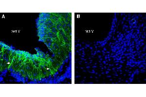 Expression of FSHR in rat hypothalamus. (FSHR 抗体  (Extracellular))