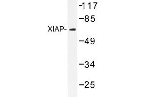 Image no. 1 for anti-X-Linked Inhibitor of Apoptosis (XIAP) antibody (ABIN272094) (XIAP 抗体)
