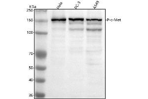 Western blot analysis of Met (c-Met) using anti-Met (c-Met) antibody (ABIN7603438).