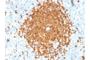 Immunohistochemistry (IHC) image for anti-POU Class 2 Associating Factor 1 (POU2AF1) (AA 148-255) antibody (ABIN6940356)