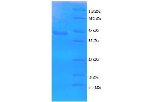 SDS-PAGE (SDS) image for Cardiac Troponin I (TNNI3) (AA 1-146), (partial) protein (GST tag) (ABIN7479330)