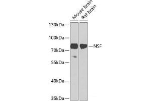 Western blot analysis of extracts of various cell lines using NSF Polyclonal Antibody at dilution of 1:1000. (NSF 抗体)