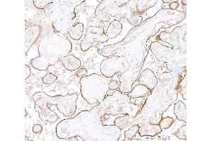 Immunohistochemistry (IHC) image for anti-Thrombomodulin (THBD) (AA 17-515) antibody (ABIN7795643) (Recombinant Thrombomodulin 抗体  (AA 17-515))