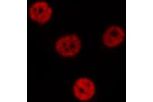 ABIN6275418 staining  NIH-3T3 cells by IF/ICC. (S100A16 抗体  (Internal Region))