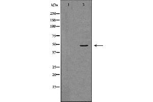 Western blot analysis of K562 whole cell lysates, using TNFRSF11B  Antibody. (Osteoprotegerin 抗体  (Internal Region))